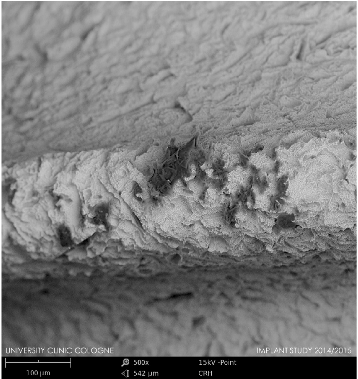 Organic Contaminations on Dental Implants – SEM Surface Analysis Showed Significant Variations in the Production Quality of 140 Implants