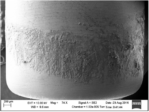 Investigation Of Epithelial Tissue Attachment To Modified Titanium Healing Abutment Surfaces