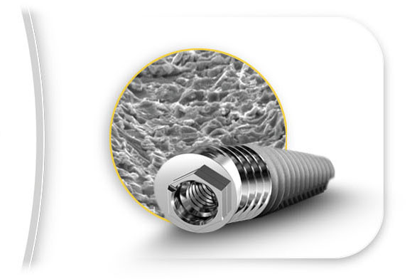 Peri-Implantitis Risk Management