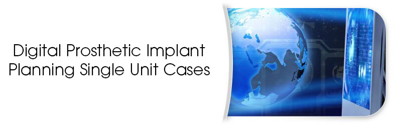 Digital Prosthetic Implant Planning Single Unit Cases