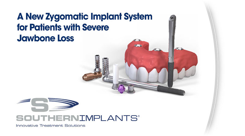 A New Zygomatic Implant System for Patients with Severe Jawbone Loss