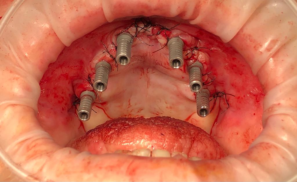 dr_vorster_case_example_1