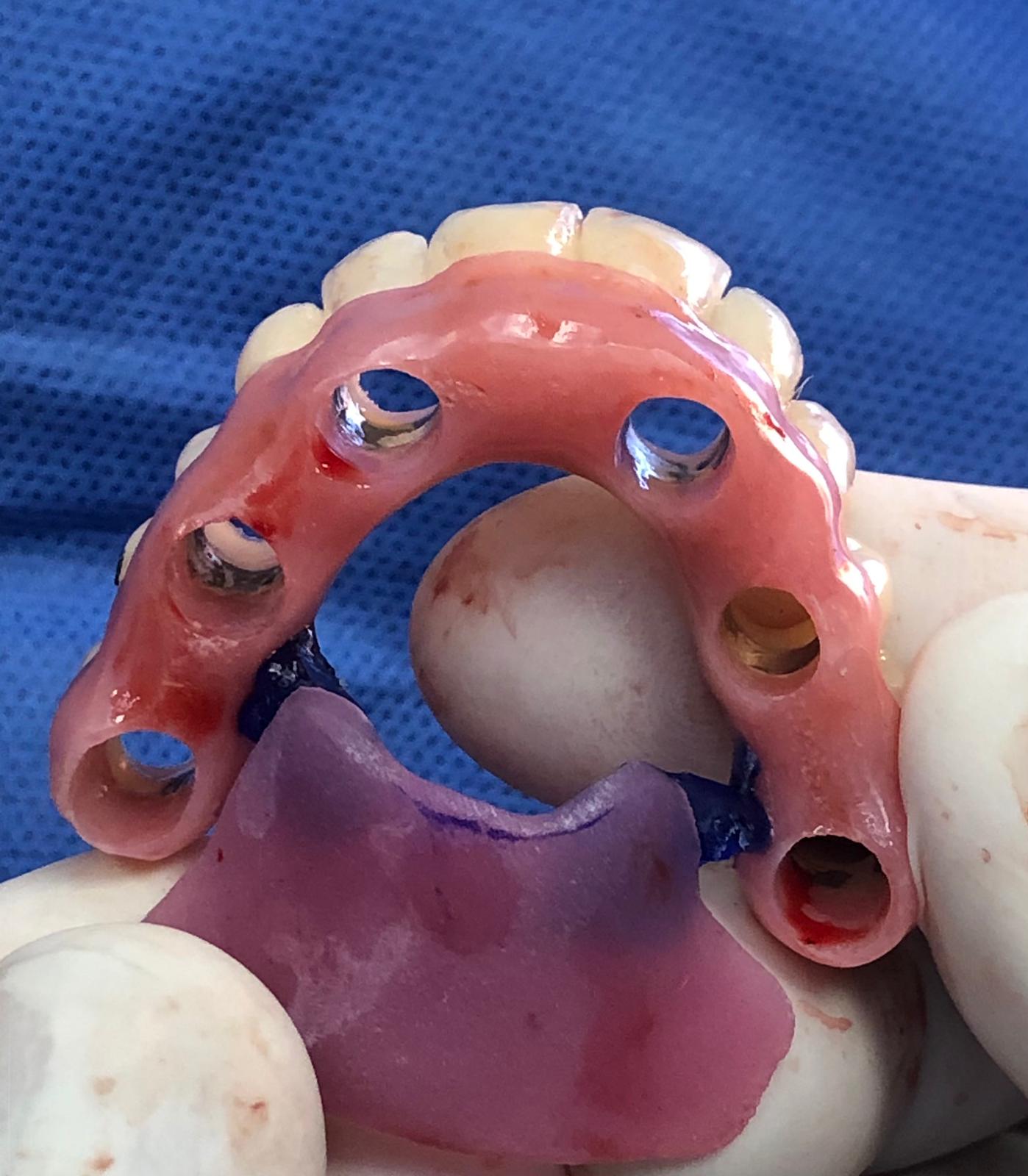 dr_vorster_case_example_2