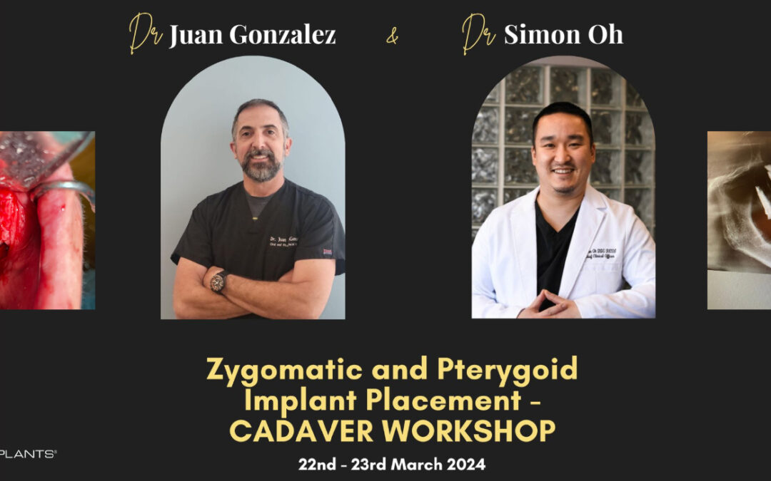 Zygomatic and Pterygoid Implant Placement: Cadaver Workshop