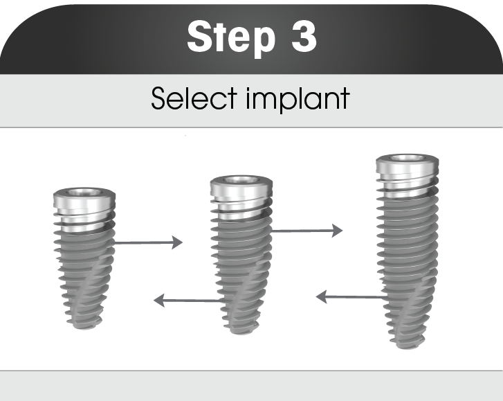 Implant System