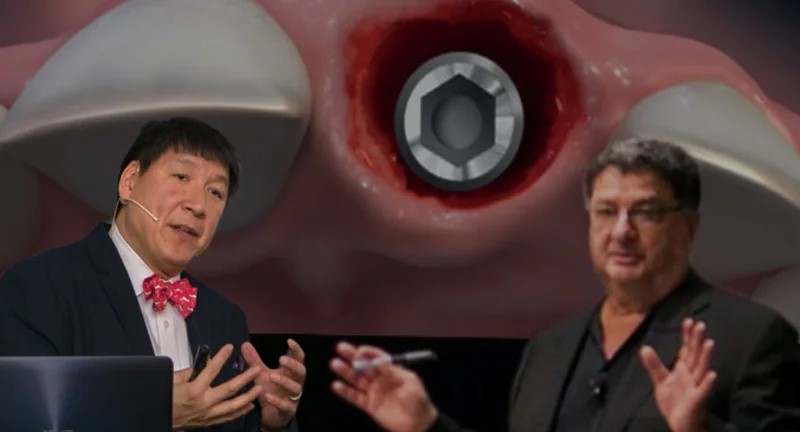 Curso práctico en vivo de 3 días: controversias e innovaciones en la estética de los implantes