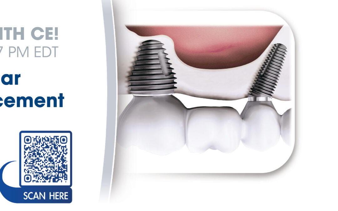 Webinar: Immediate Molar Implant Replacement