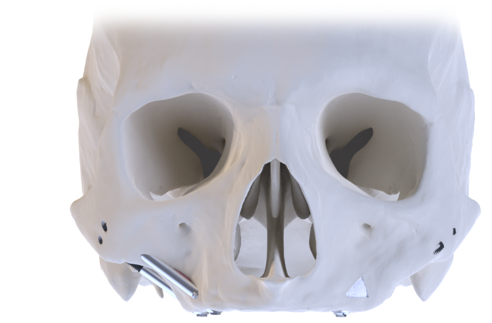 ZAGA Skull front web